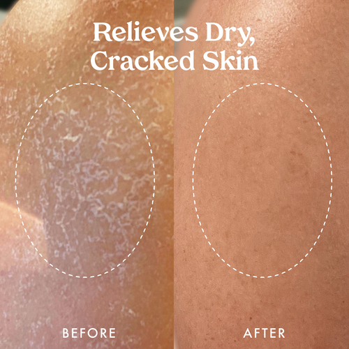 Hyaluronic Hydration Body Set 